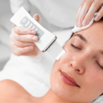 Microneedling